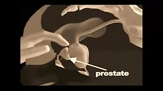 पातलो प्रेमी भयानक प्रेमिका मा सोफा